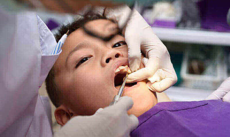 Extractions - Dentist Fairview Mall North York