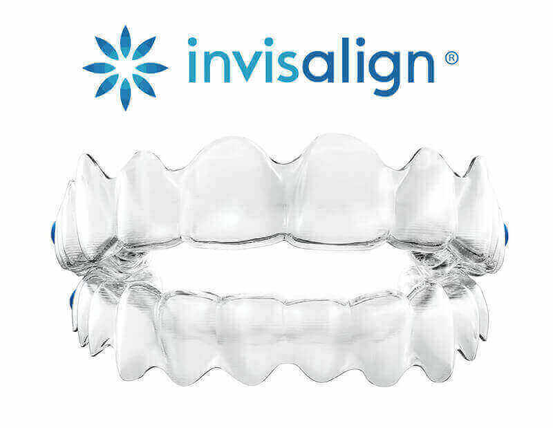 Invisalign - Dentist Fairview Mall North York